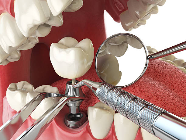 Best Tooth Pain Emergency Relief  in China Grove, NC